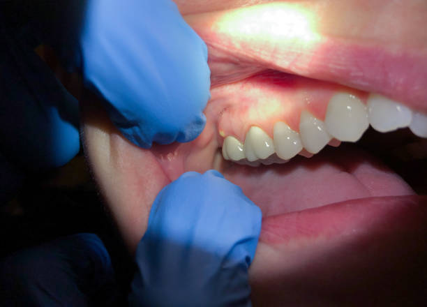 Best Pediatric Emergency Dentist in Anna, IL