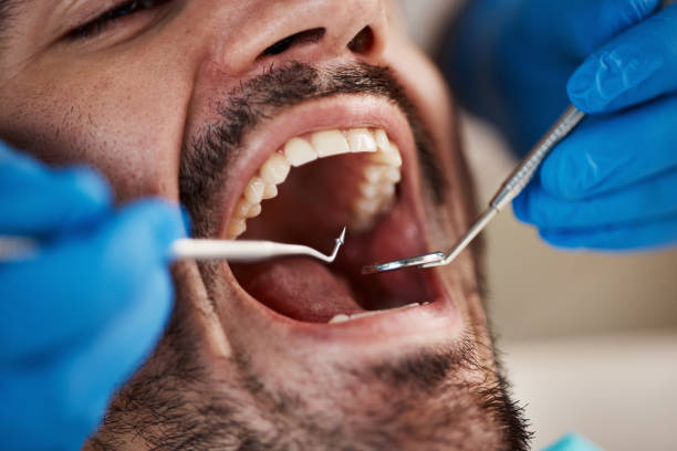 Best Emergency Dentist for Special Needs Patients in Anna, IL