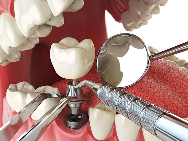 Best Mobile Emergency Dentist in Anna, IL